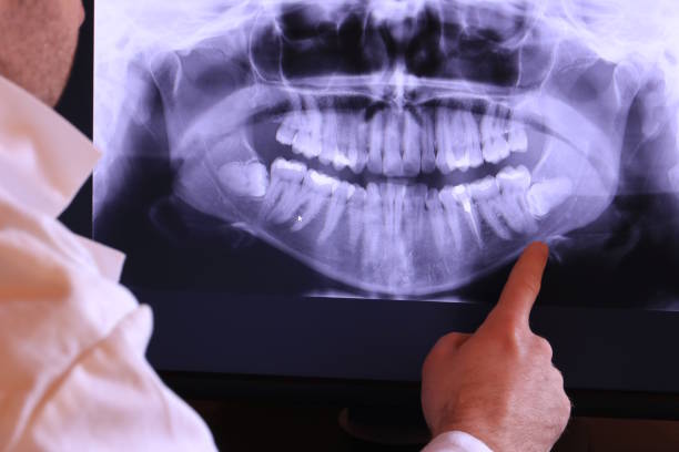 Best Dentist for Tooth Abscess  in Byram Center, NJ